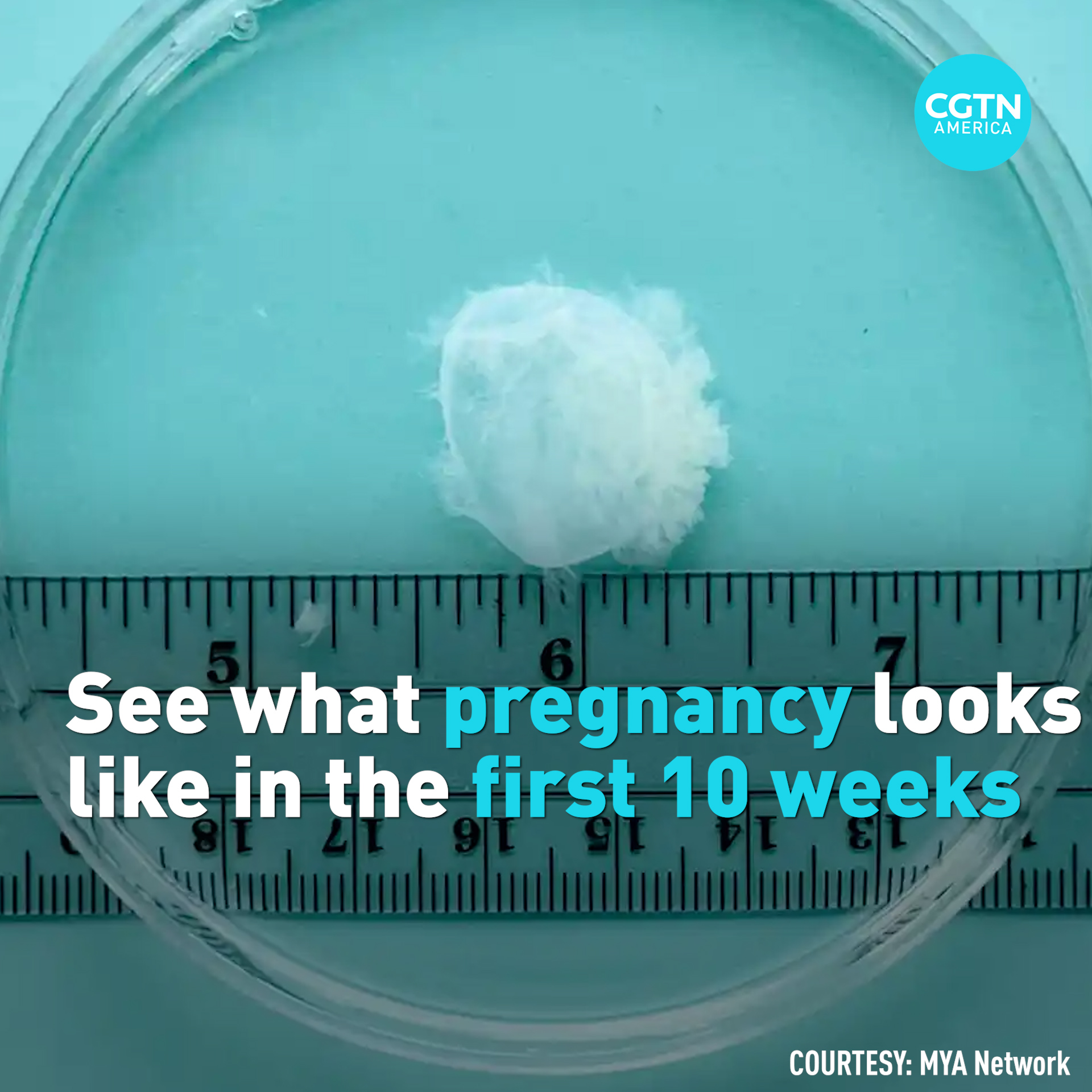 What does a pregnancy look like in the first 10 weeks? 