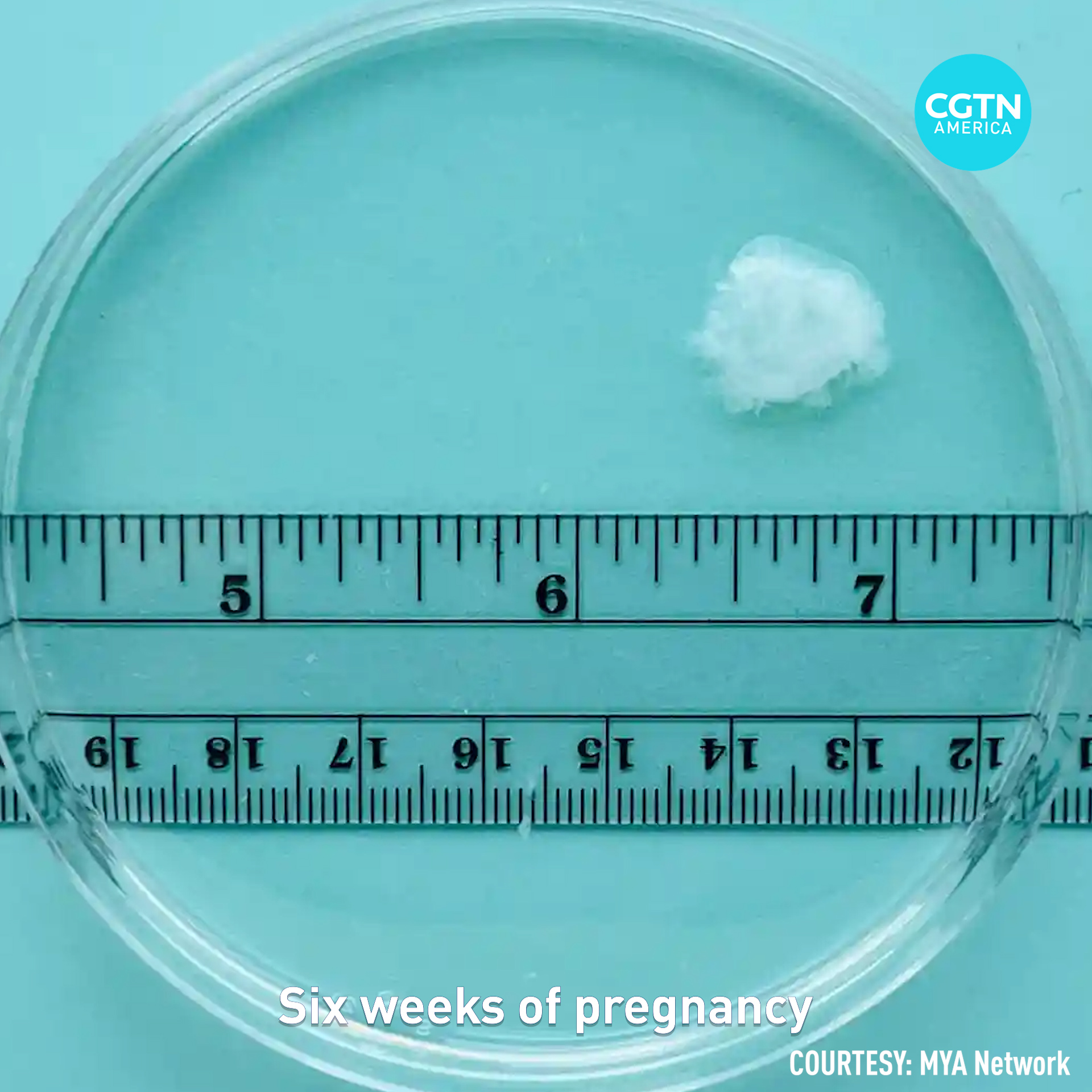 What does a pregnancy look like in the first 10 weeks? 