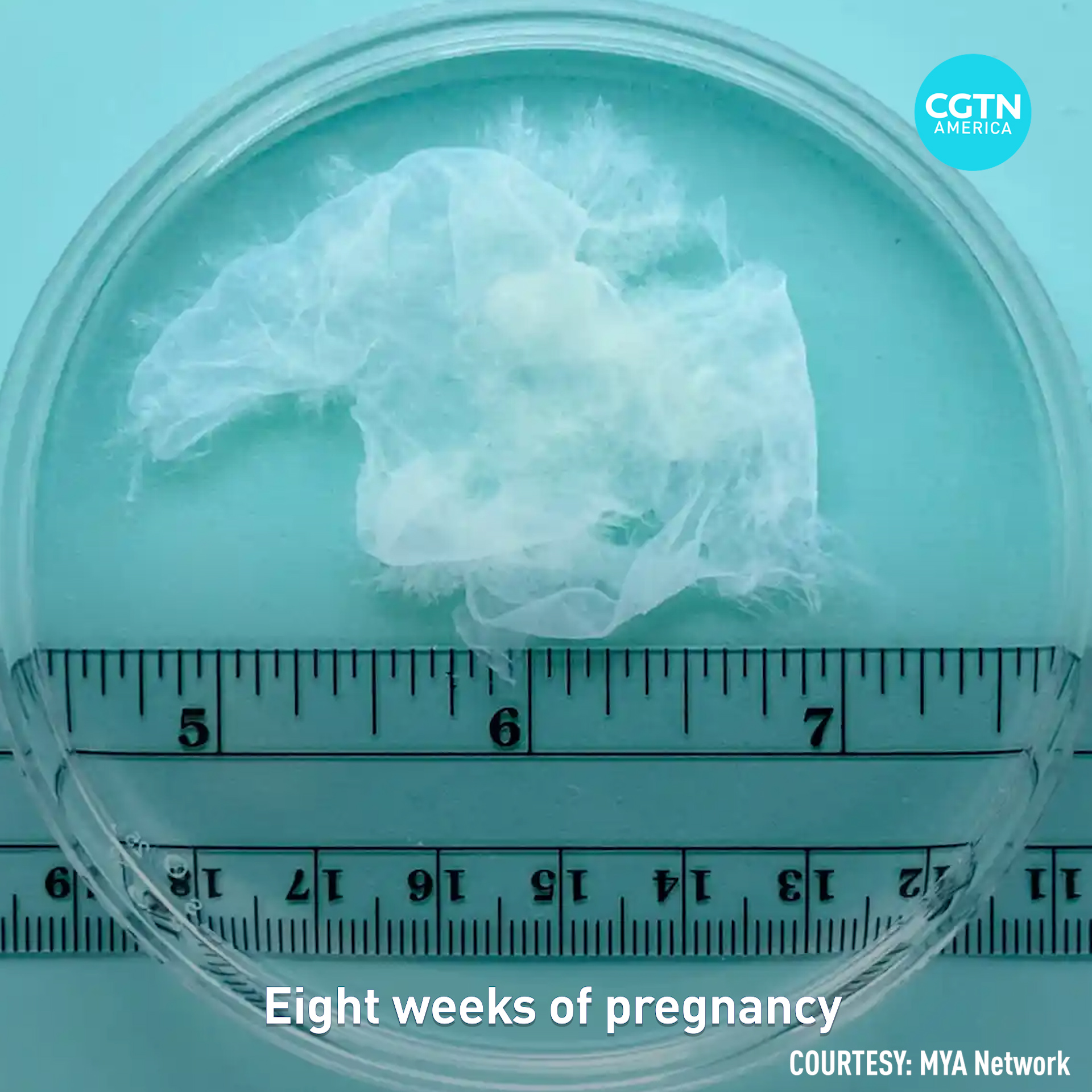 What does a pregnancy look like in the first 10 weeks? 