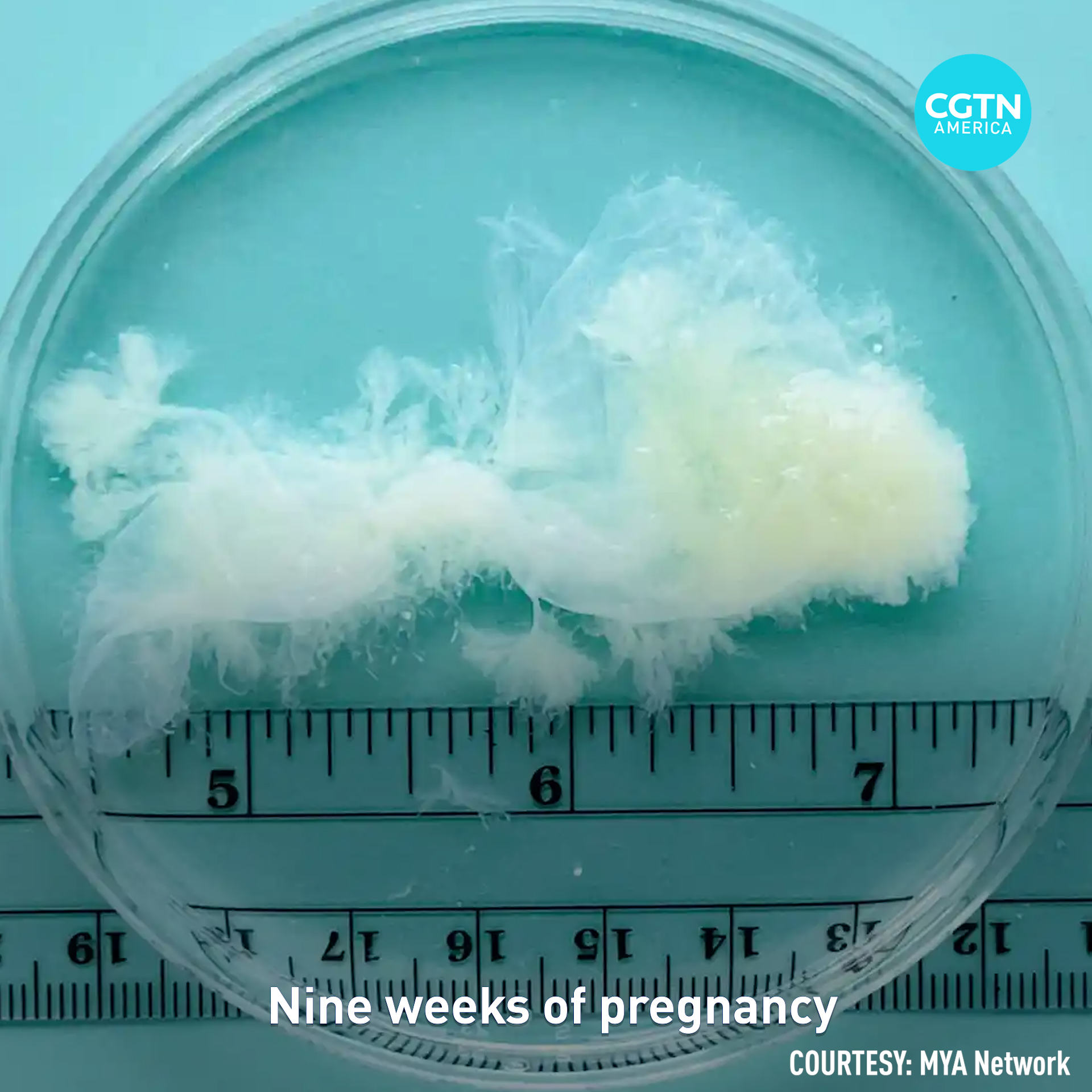 What does a pregnancy look like in the first 10 weeks? 