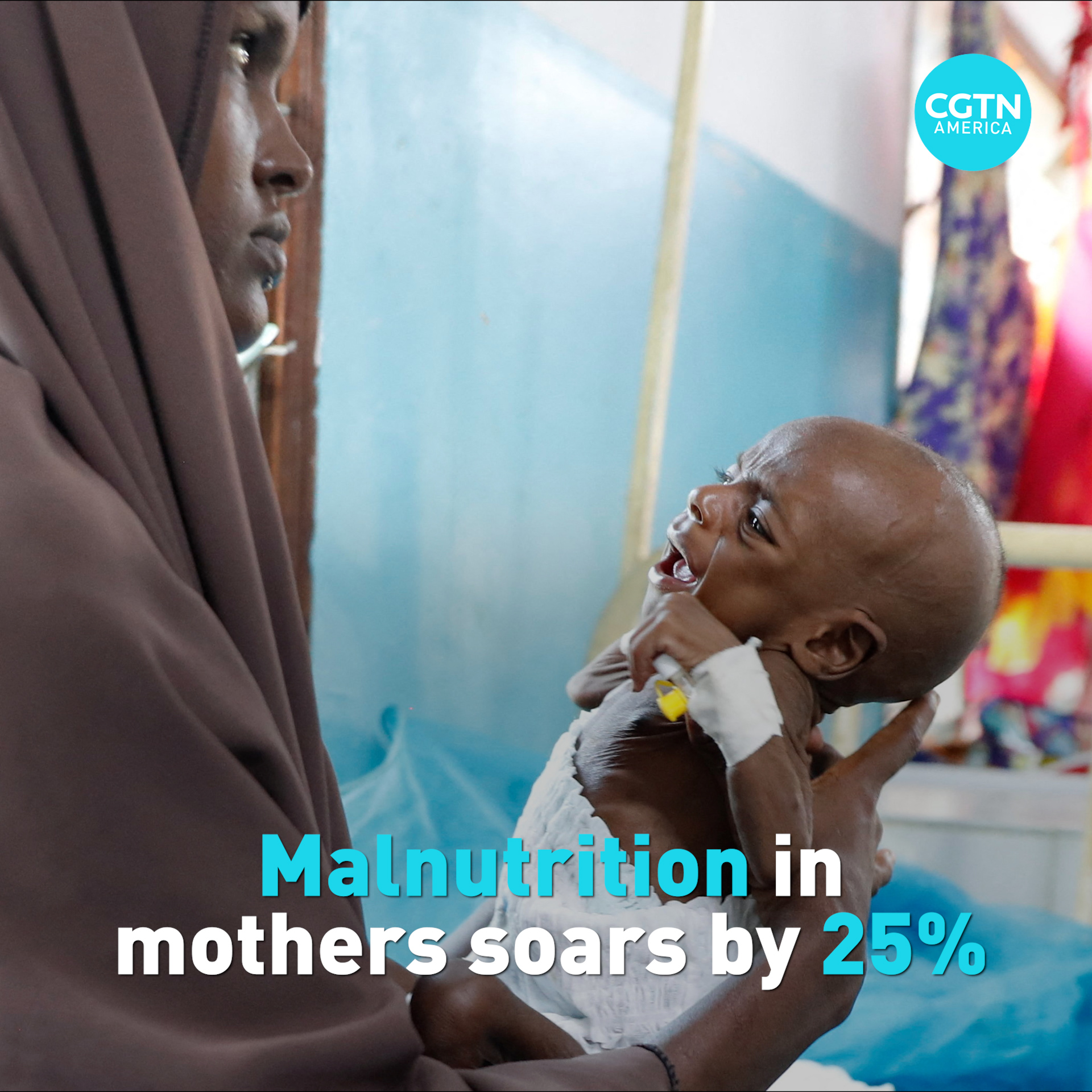 UNICEF: 25% jump in adolescent girls and women suffering from acute malnutrition
