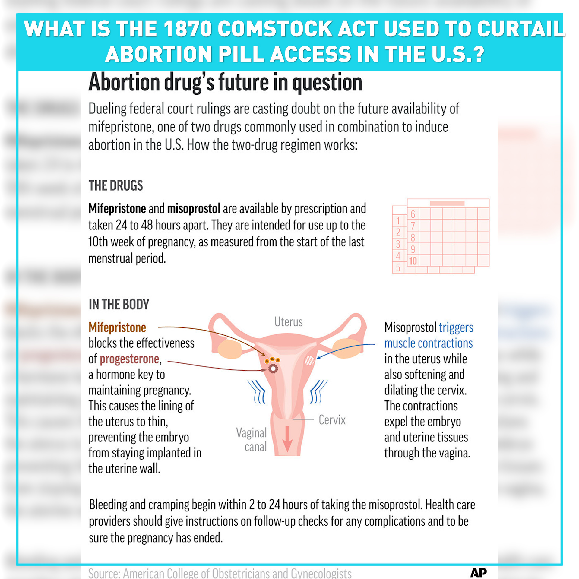 How an 1870 U.S. law is being used to block access to abortion pill 