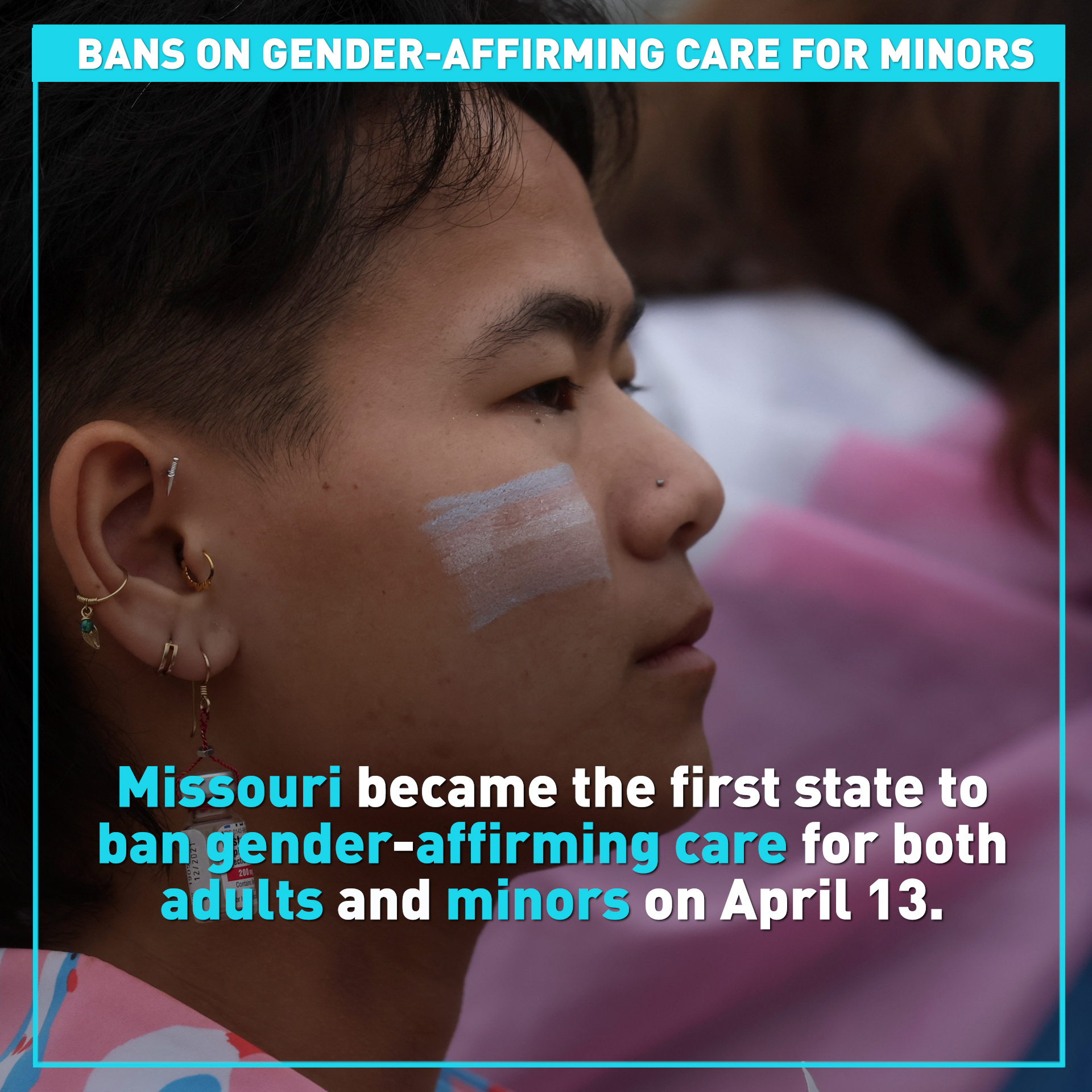 Bans on gender-affirming care for minors in 12 American states