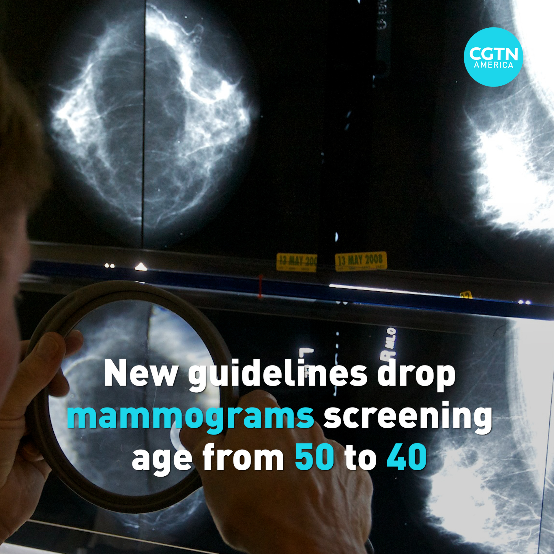 New Guidelines Drop Mammograms Screening Age From 50 To 40 Cgtn