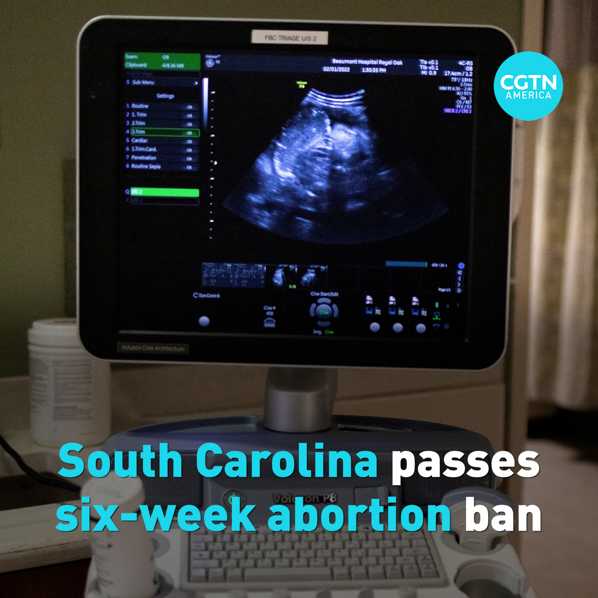 South Carolina passes six-week abortion ban