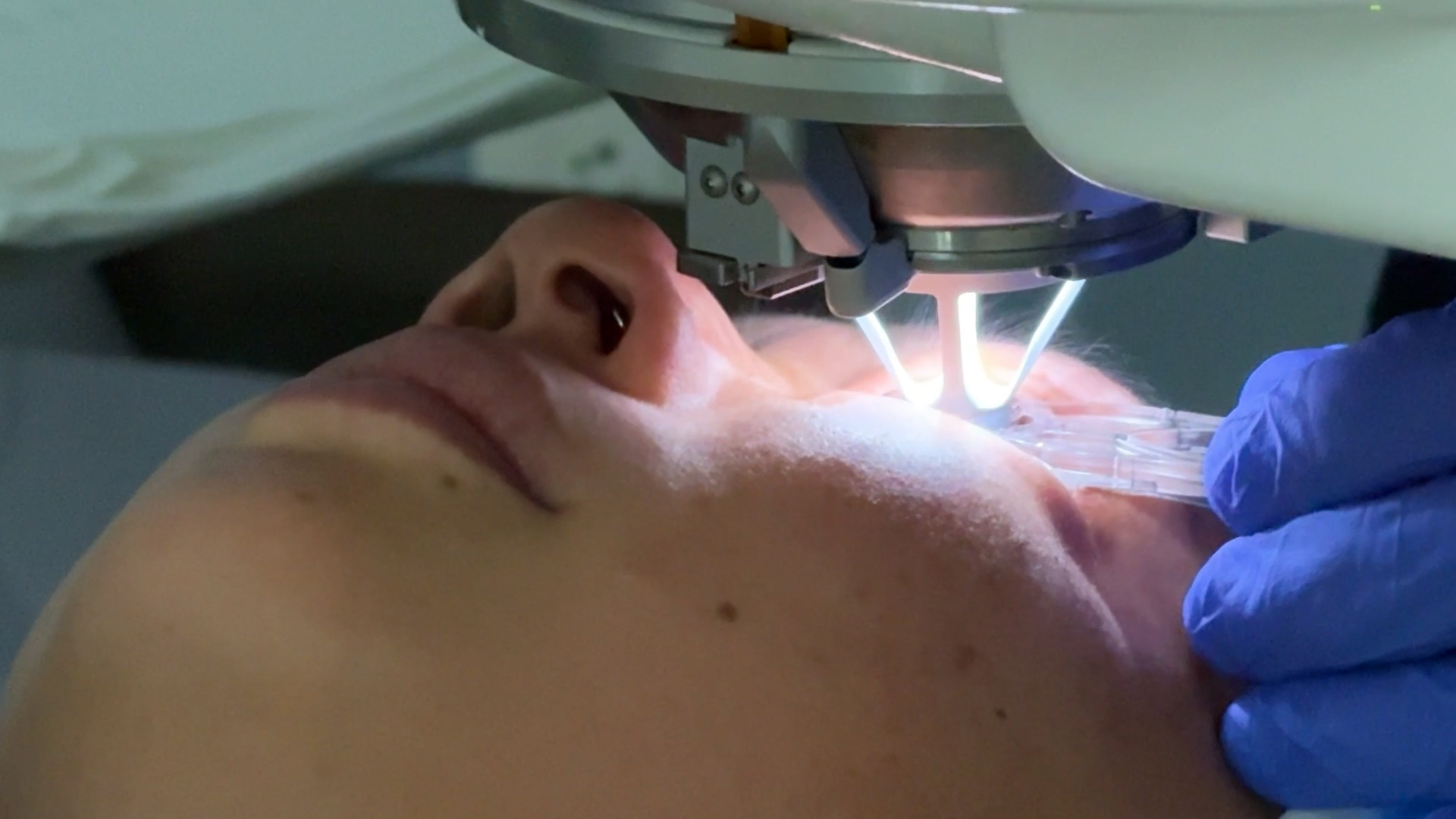 AI takes LASIK to the next level