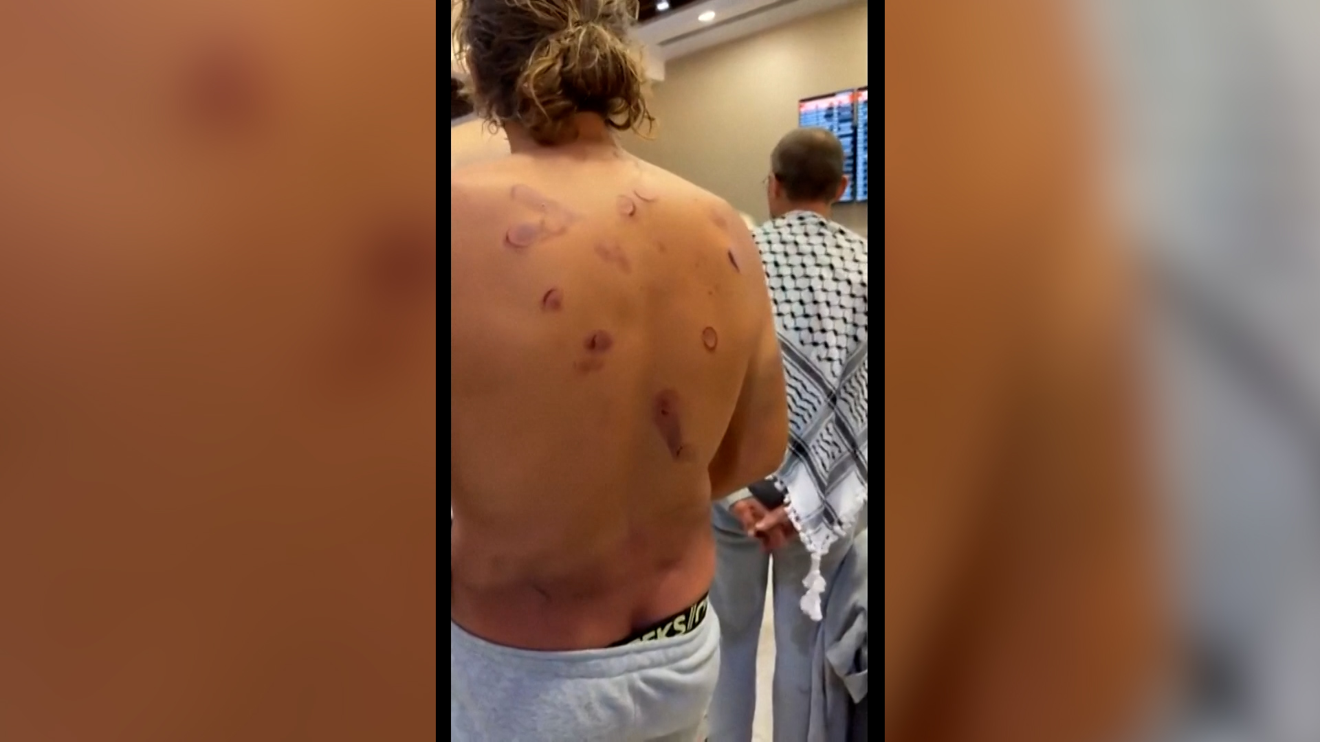 Activists recount violence by Israeli forces