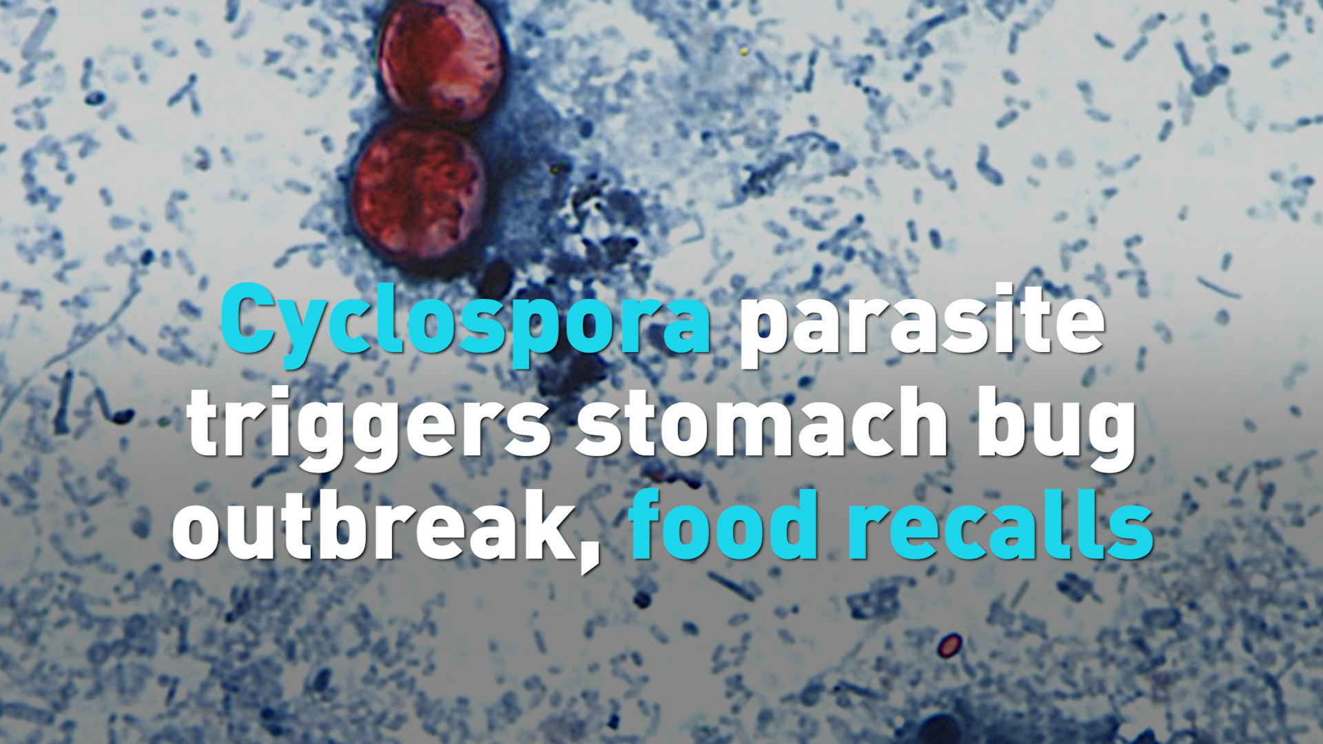 Cyclospora parasite triggers stomach bug outbreak, food recalls