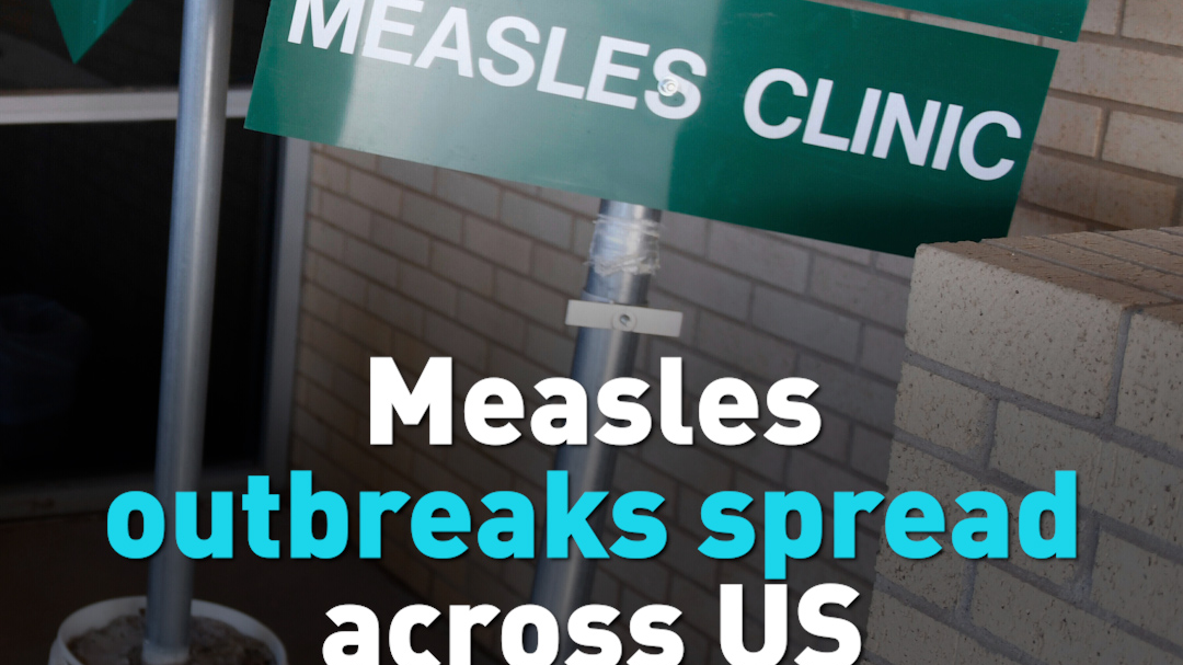 Measles outbreaks spread across US