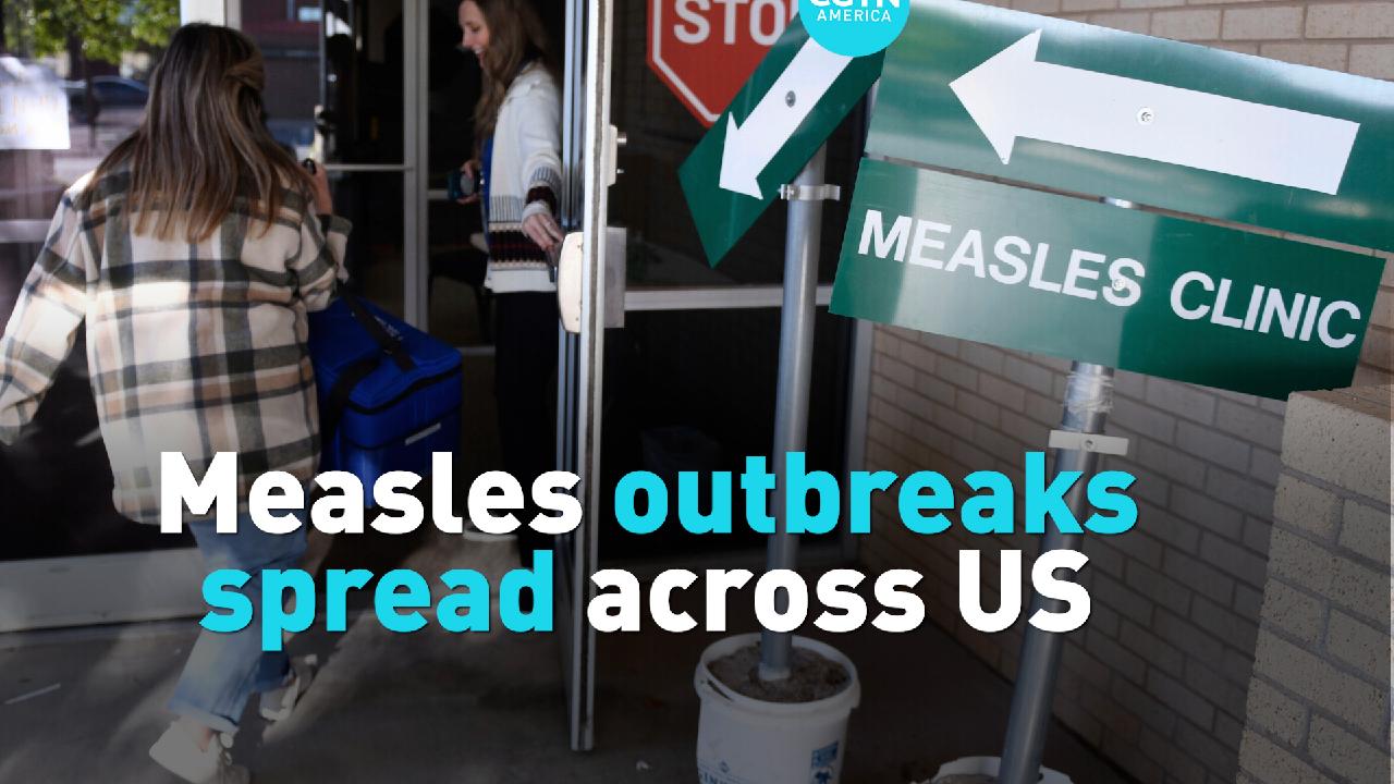 Measles outbreaks spread across US