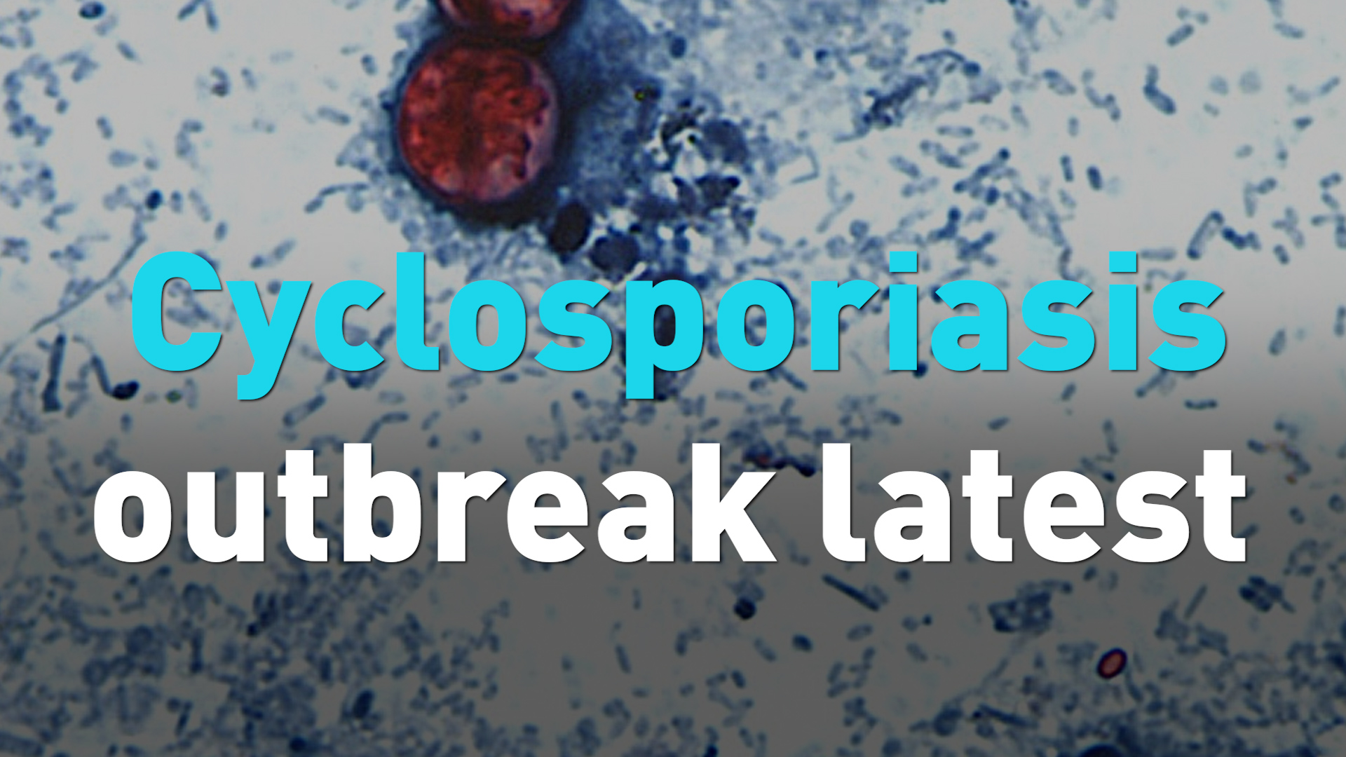 Cyclosporiasis outbreak latest 