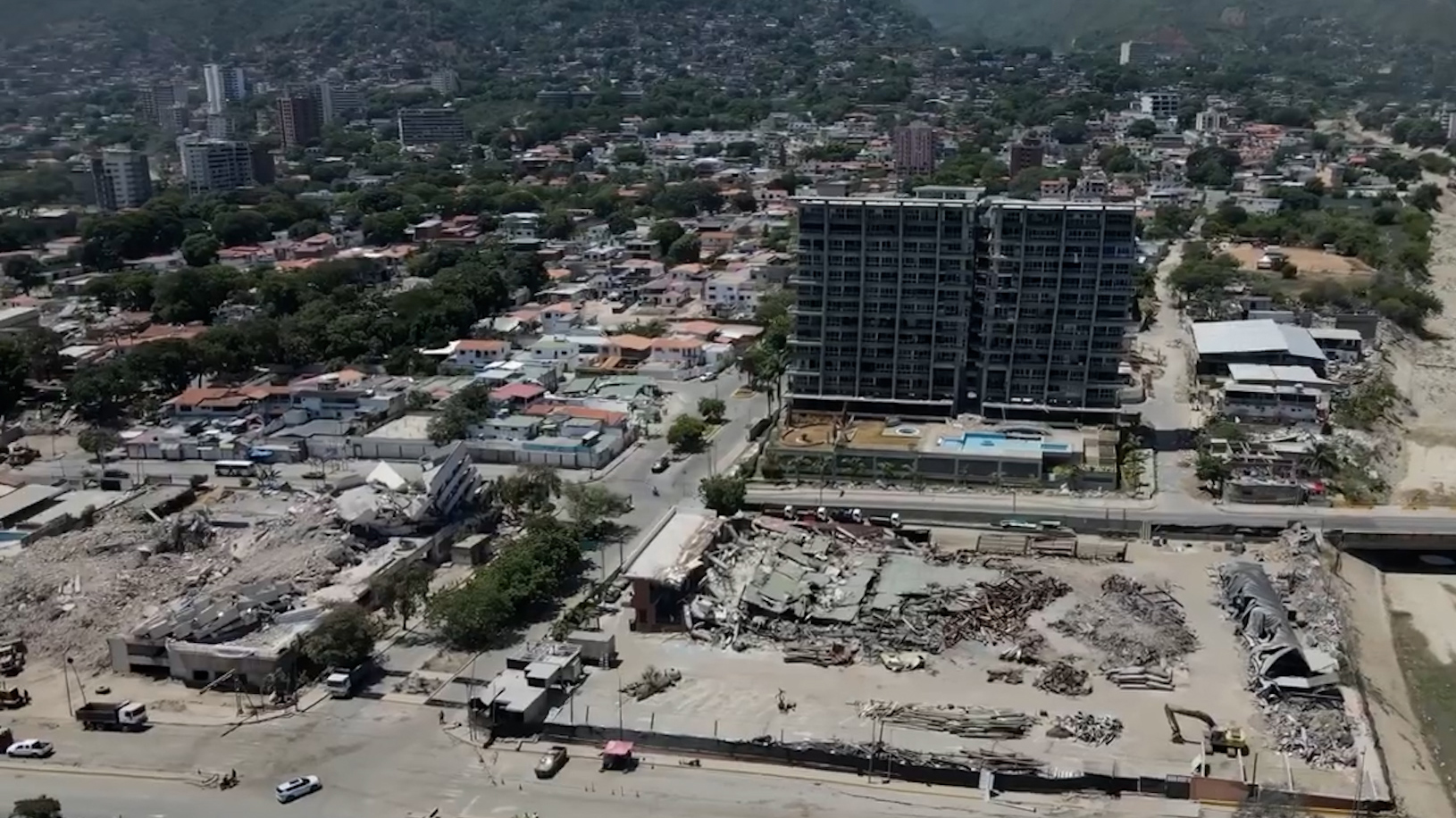 Venezuela earthquake amputees begin long road to recovery